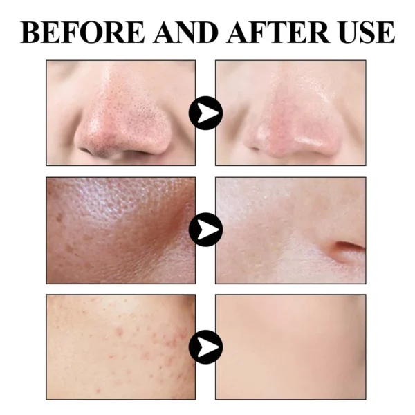West & Month Blackhead Remove Solid Mud Film Refreshing Skin Cleaning Face Mask Moisturize Control Oil Shrink Pores Skin Care - Image 3