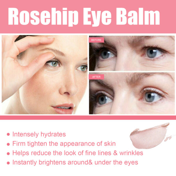 Women Extra Renewing Rosehip Eye Balm For Face Lifting Moisturizing Balm Stick Deep Hydration Moisturizer Eye Care - Image 3