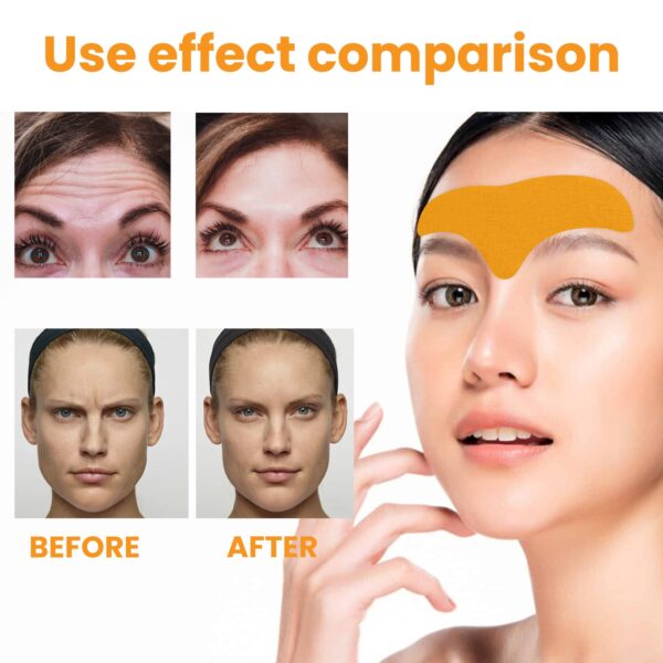 Anti-Aging Collagen Gel Patch - 10pcs Forehead Line Removal, Firming Mask, Frown Lines, Face Skin Care Stickers - Image 3